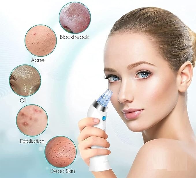 black heads remover vaccum