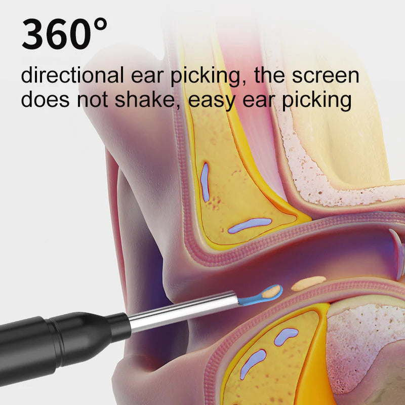 Gadgetsaga - Visual Smart Ear Cleaner