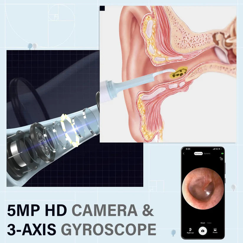 Gadgetsaga - Visual Smart Ear Cleaner