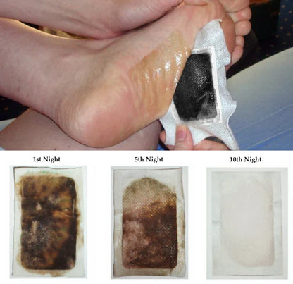 Detox Foot Pads